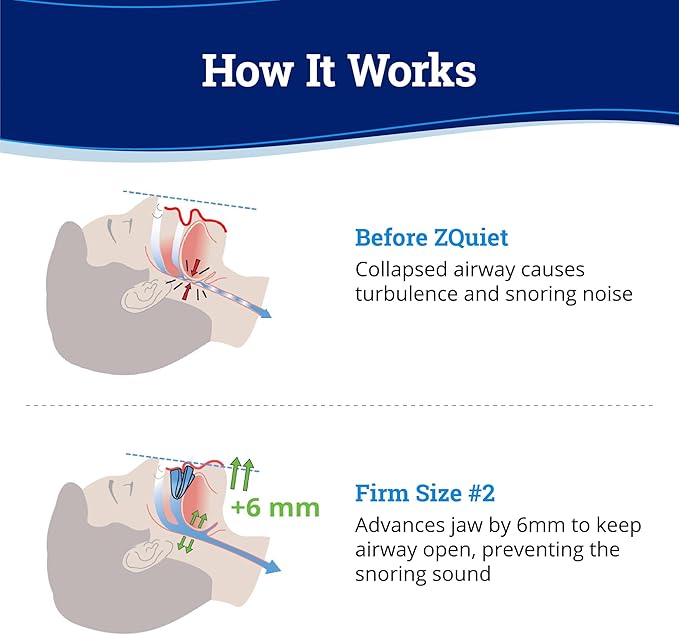 ZQuiet, Anti-Snoring Mouthpiece, Firm Size #2, Strong & Durable Mouthguard, Ideal for Those Prone to Teeth Grinding & Clenching, Made in USA, Size 2
