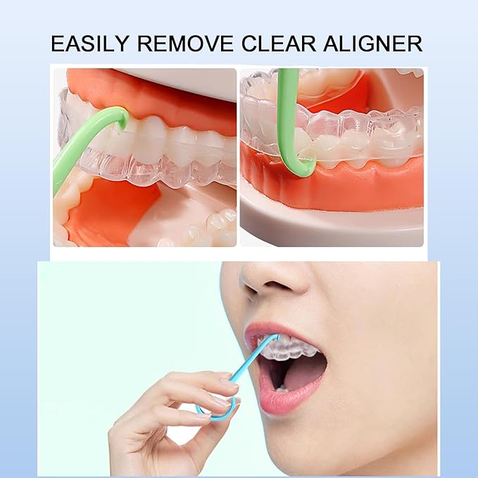 5PCS Aligner Removal Tool, Pink Clear Aligner RemoverTools for Invisalign Removable Retainers, Aligners,Braces Removal Kit (5PCS Pink)
