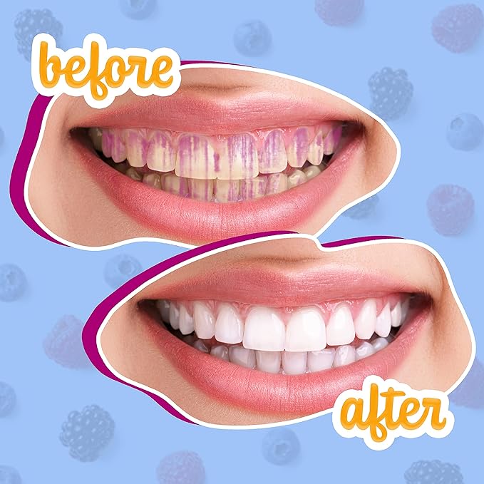 Lingito Plaque/Dental Disclosing Tablets, A Teeth Coloring Tablets Plaque Finder Solution to Effectively Remove Plaque and Tartar Buildup, Improves Oral Care (4 Month Supply - 120 Pack)