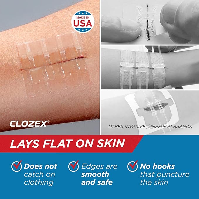 Clozex Emergency Laceration Closures - Repair Wounds Without Stitches, FSA HSA Eligible Skin Closure Device for 2 Individual Wounds Or Combine for Total Length of 2 Inches