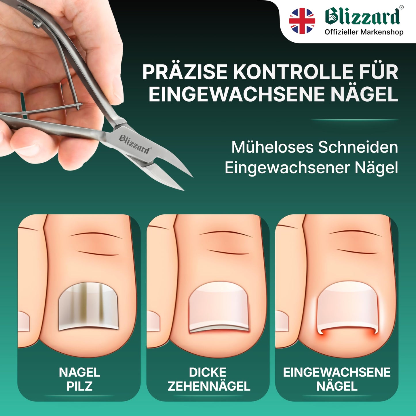 Ingrown Nail Clippers for Men with Ingrown Toenails – Blizzard Podiatrist Toenail Clipper Set German Forged (15cm - Arrow Point - Smooth)
