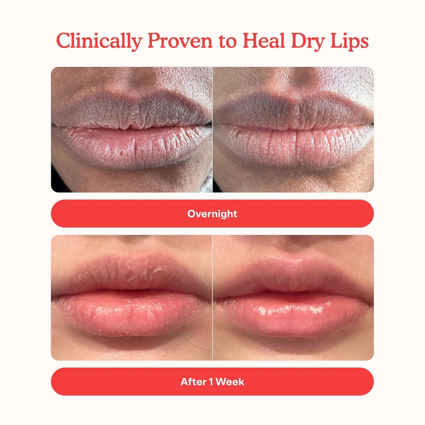 Tower 28 LipSoftie Hydrating Tinted Lip Treatment Balm, Moisturizing Lip Mask for Chapped Lips - Sugar Plum Flavor, Sheer Mauve