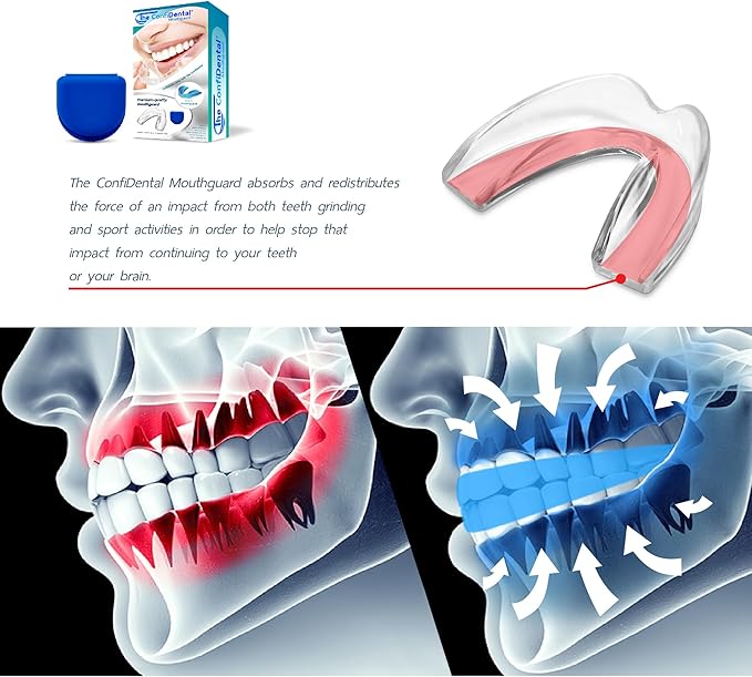 The ConfiDental Mouth Guard for Grinding Teeth at Night - Model for Small Mouth Pack of 6 Moldable Dental Night Guards for Teeth Grinding and Clenching Teeth Grinding Mouth Guard for Sleep