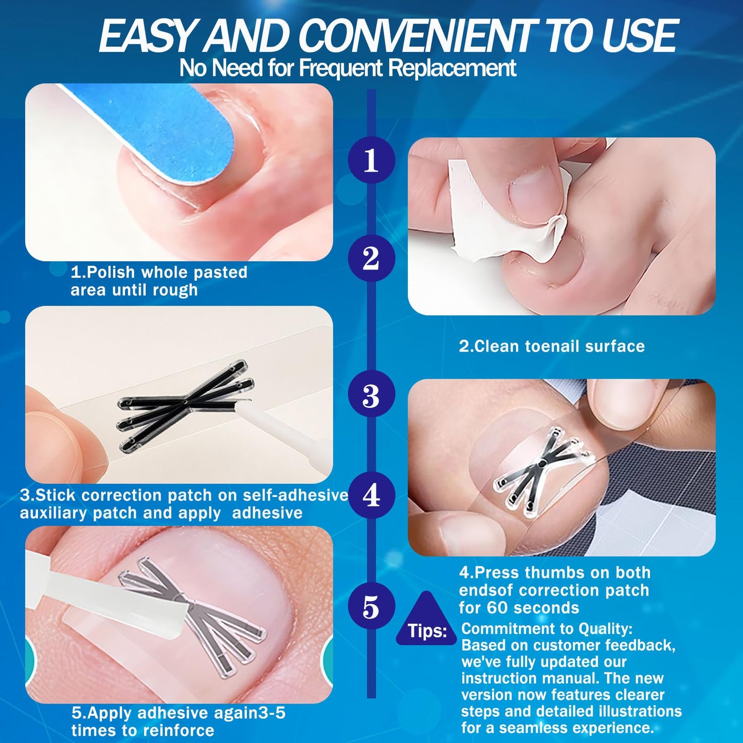Ingrown Toenail Treatment with Upgraded 6-Angle Shape,Titanium Alloy Ingrown Toenail Corrector for Quick Relief,At-Home Ingrown Toenail Removal Kit for Toenail Curled Corrector,9Pcs