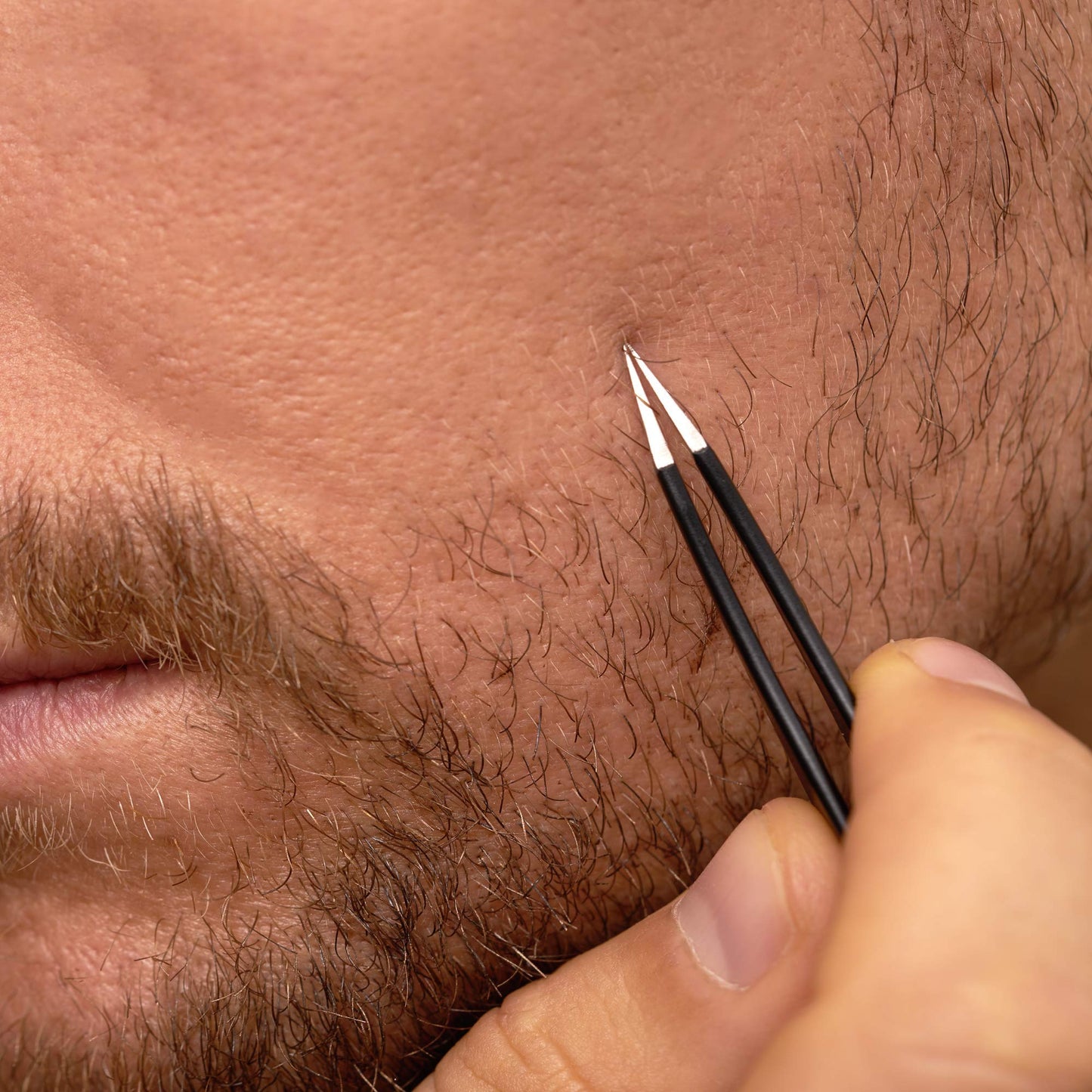 Tweezerman G.E.A.R. Ingrown Hair SplinterTweezer