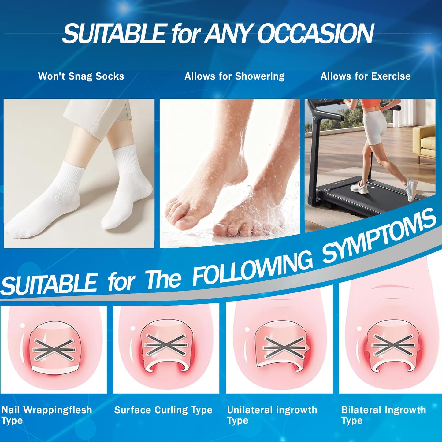 Ingrown Toenail Treatment with Upgraded 6-Angle Shape,Titanium Alloy Ingrown Toenail Corrector for Quick Relief,At-Home Ingrown Toenail Removal Kit for Toenail Curled Corrector,9Pcs
