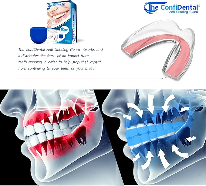 The ConfiDental Mouth Guard for Teeth Grinding and Clenching - Moldable Dental Nightguard Protection for Moderate Grinding with Additional Heavy-Duty - 4-Pack (3 Regular, 1 Heavy-Duty)