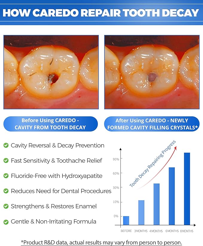Upgraded Taste - CAREDO Cavity Reversal Hydroxyapatite Toothpaste for Adults, Cavity Tooth Filler as Remineralizing Home Cavity Repair, Fluoride Free Reverse Cavities for Tooth Decay Repair, 2-Pack
