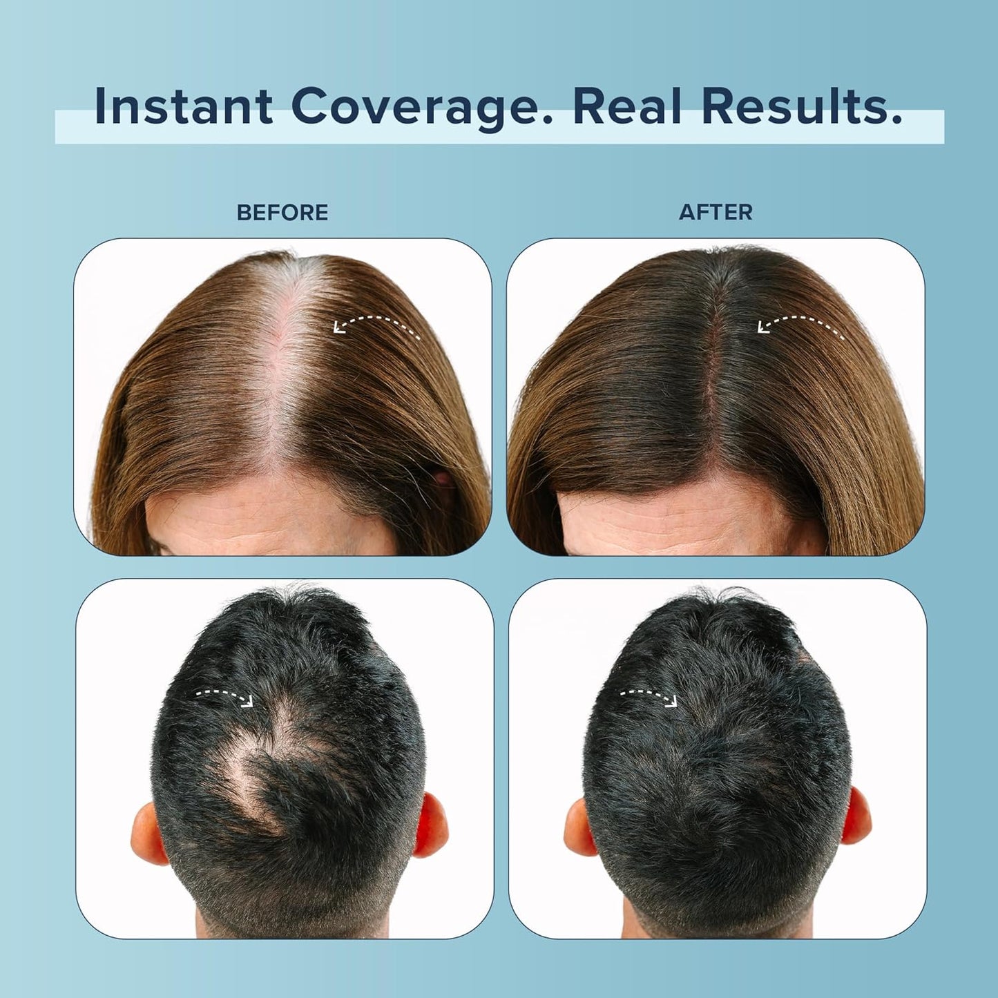 TRUHAIR Color Fibers Root Coverage & Density Booster | Quick-Apply Root Touch Up Hair Color | Natural Color Matching, Gray Hair Cover up to Color Gray Roots - 11 Hair Colors Available (Light Blonde)