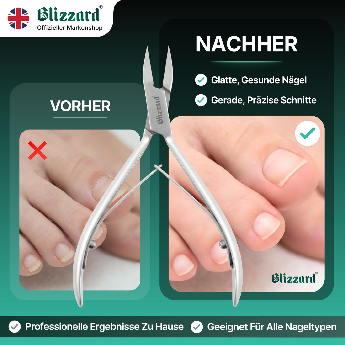 Ingrown Nail Clippers for Men with Ingrown Toenails – Blizzard Podiatrist Toenail Clipper Set German Forged (15cm - Arrow Point - Smooth)