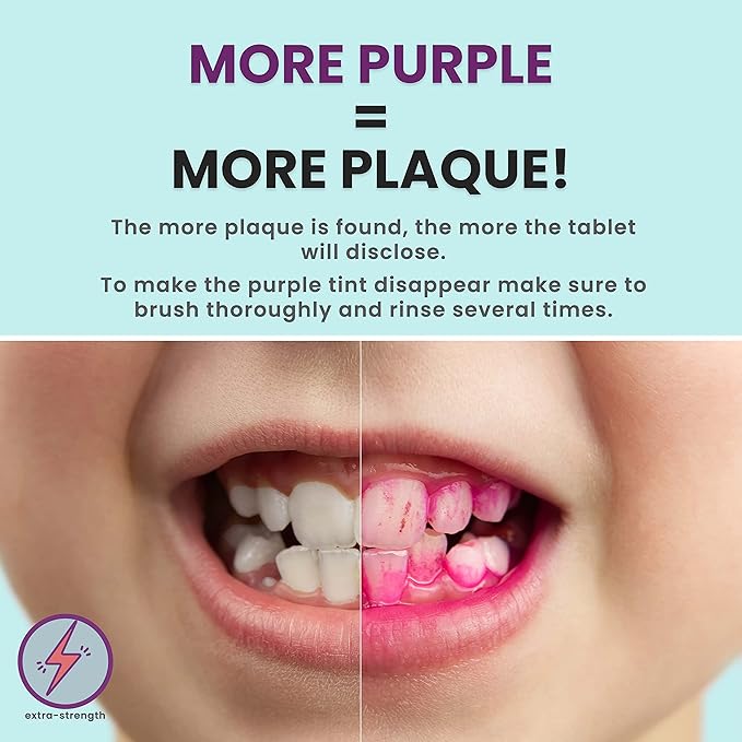 Plaque Disclosing Tablets for Teeth, 96 Count, Dental Disclosing Tablets for Kids or Adults, Shows Plaque, Helps Teach Kids Teeth-Brushing Habits for Clean Smile, by Fresh Knight, (Pack of 2)