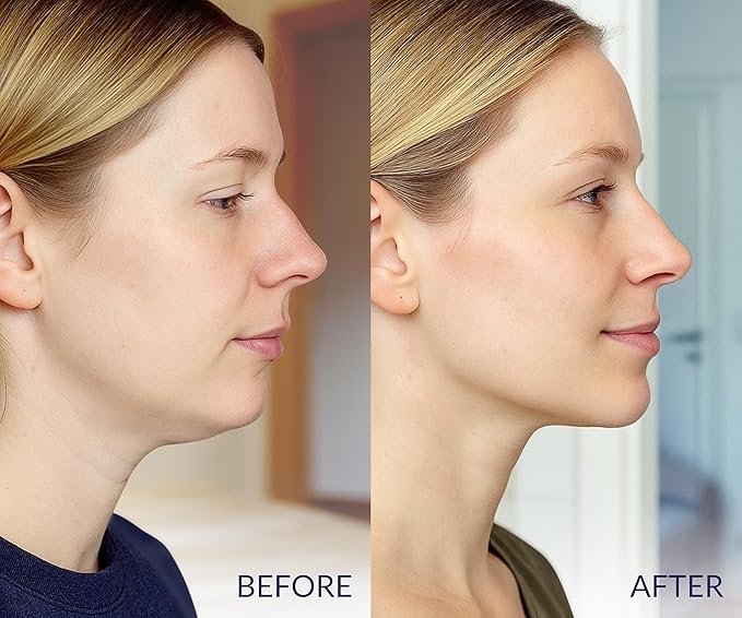 STYLIA V Line Lifting Collagen Mask - Lift, Firm & Contour Jawline - Tightening Double Chin Strap with Hyaluronic Acid & Aloe - Neck Lift & Face Tightening Mask - Jawline Shaper Face Lift Tape (10PC)