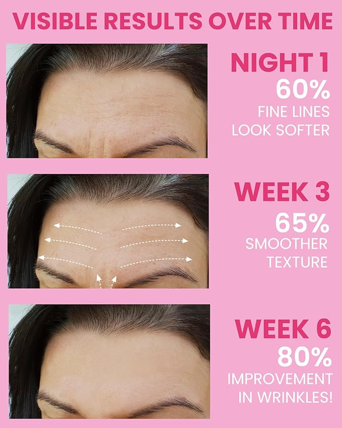 Akissos Anti Wrinkle Patches 160PCS Update Version Full Facial Forehead Wrinkle Patches, Face Tape for Wrinkles Overnight to Smooth Lift Forehead Eyebrow Frown 11 Eye Crow's Feet Smile Lines Lip