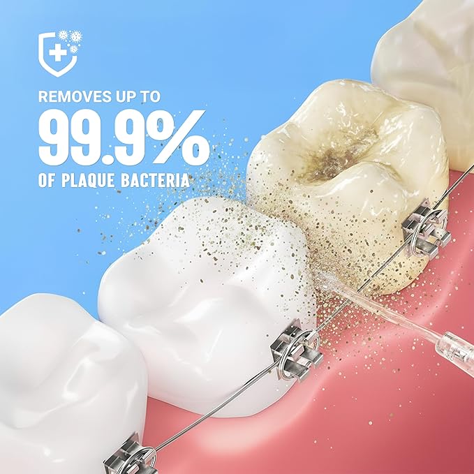 Portable Water Flosser for Teeth - 4 Modes Cordless Oral Irrigator with 300ML Tank, 360° Rotating Nozzle, 4 Jet Tips, Rechargeable, IPX7 Waterproof, Low Noise Gravity Ball Design (M159 - White)