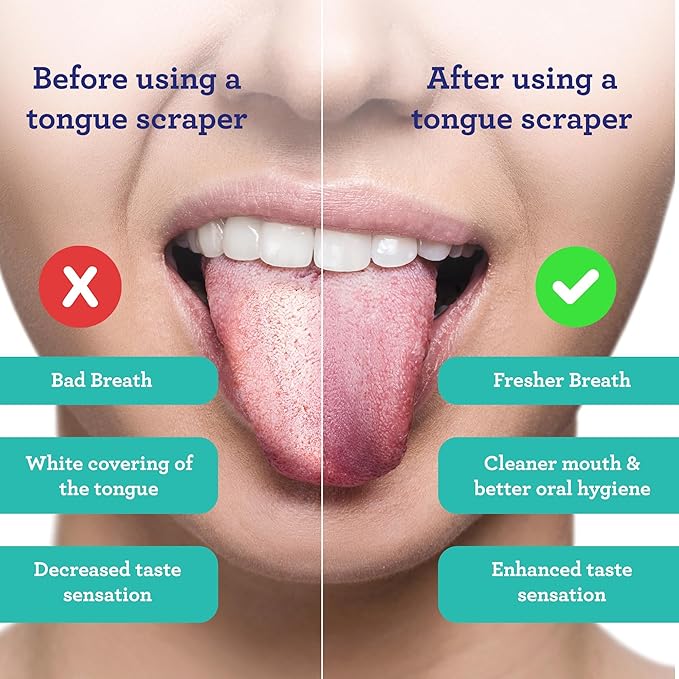 GuruNanda Tongue Scraper for Adults (4-Pack) with Travel Case, 420 Medical Grade Stainless Steel, Aids in Fresh Breath & Oral Care - Travel-Friendly