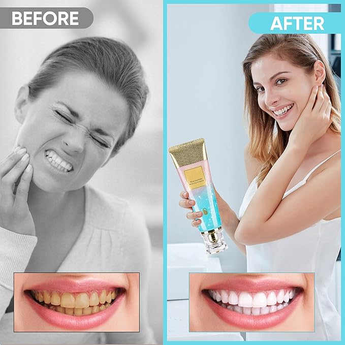 Niacinamide Whitening Toothpaste, Triple Action Whitening with Natural Gentle Care Deep Stains Radiant Smile Natural & Gentle Formula Fresh Breath (1)
