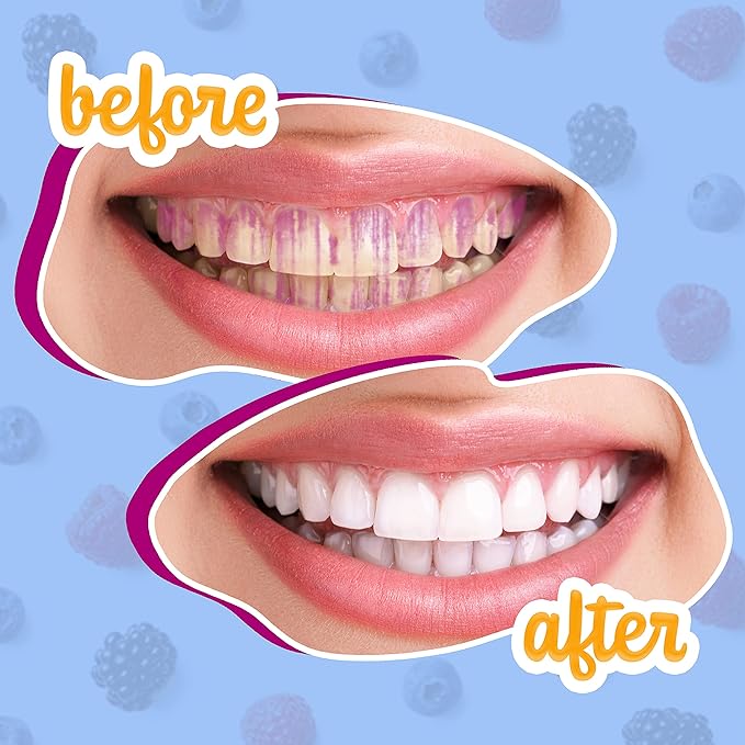 Lingito Plaque/Dental Disclosing Tablets, A Teeth Coloring Tablets Plaque Finder Solution to Effectively Remove Plaque and Tartar Buildup, Improves Oral Care (2 Month Supply - 60 Pack)