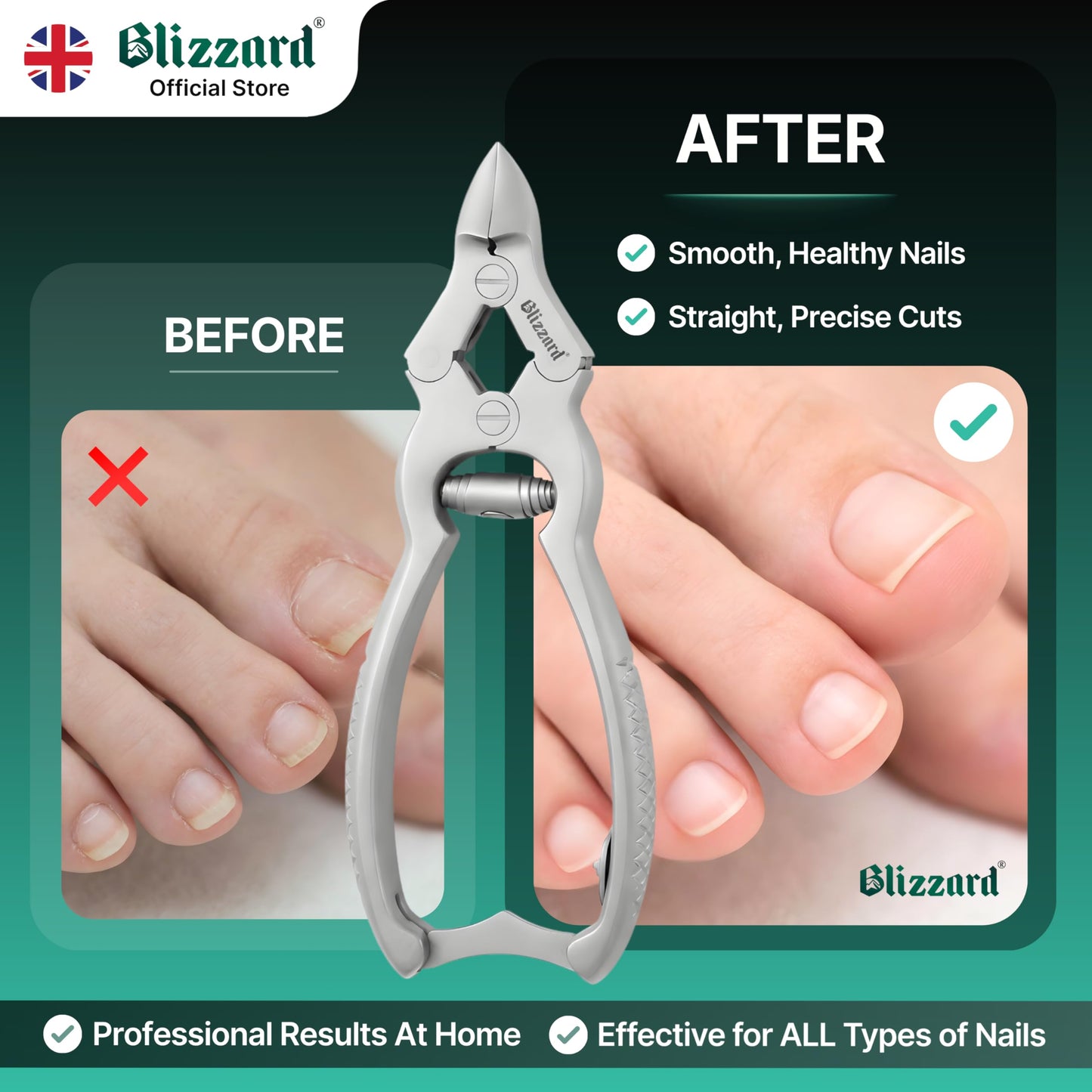 Blizzard Toenail Clippers - Podiatrist Toe Nail Clippers for Thick Nails for Seniors - German Forged Nail Cutter - Heavy Duty Double Action Nail Clippers for Men with Toenail File - 6" Barrel Spring