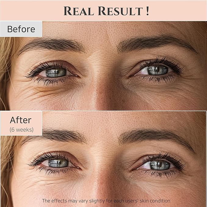 Beauty of Joseon Revive Eye Serum with Retinal Niacinamide Correction for Puffy Eye Bags Fine Lines Dark Circles Wrinkles, Korean Skin Care 30ml, 1 fl.oz, 2 Packs
