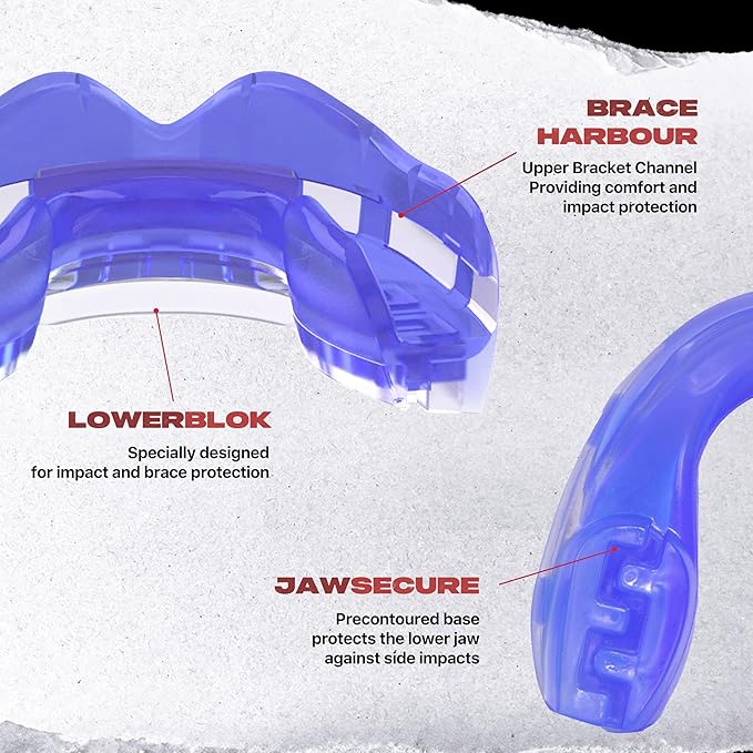 SafeJawz Mouthguard for Braces, One Size Re-Mouldable Mouth Guard with Case for Boxing, Basketball, Football, MMA, Lacrosse, Hockey and All Contact Sports (Ice Blue)