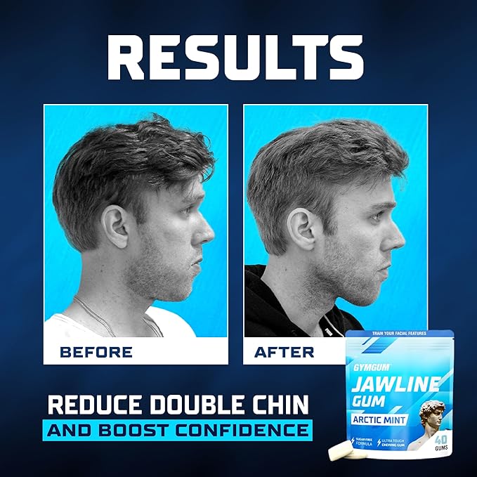 Gymgum Jawline Gum | Hard Chewing Gum For Jaw Strength | Train Your Facial Features - Mewing Jaw Gum | Ultimate Jawline Exerciser | 0 Calories & Sugar Free Hard Gum (Arctic Mint, 120 Count)