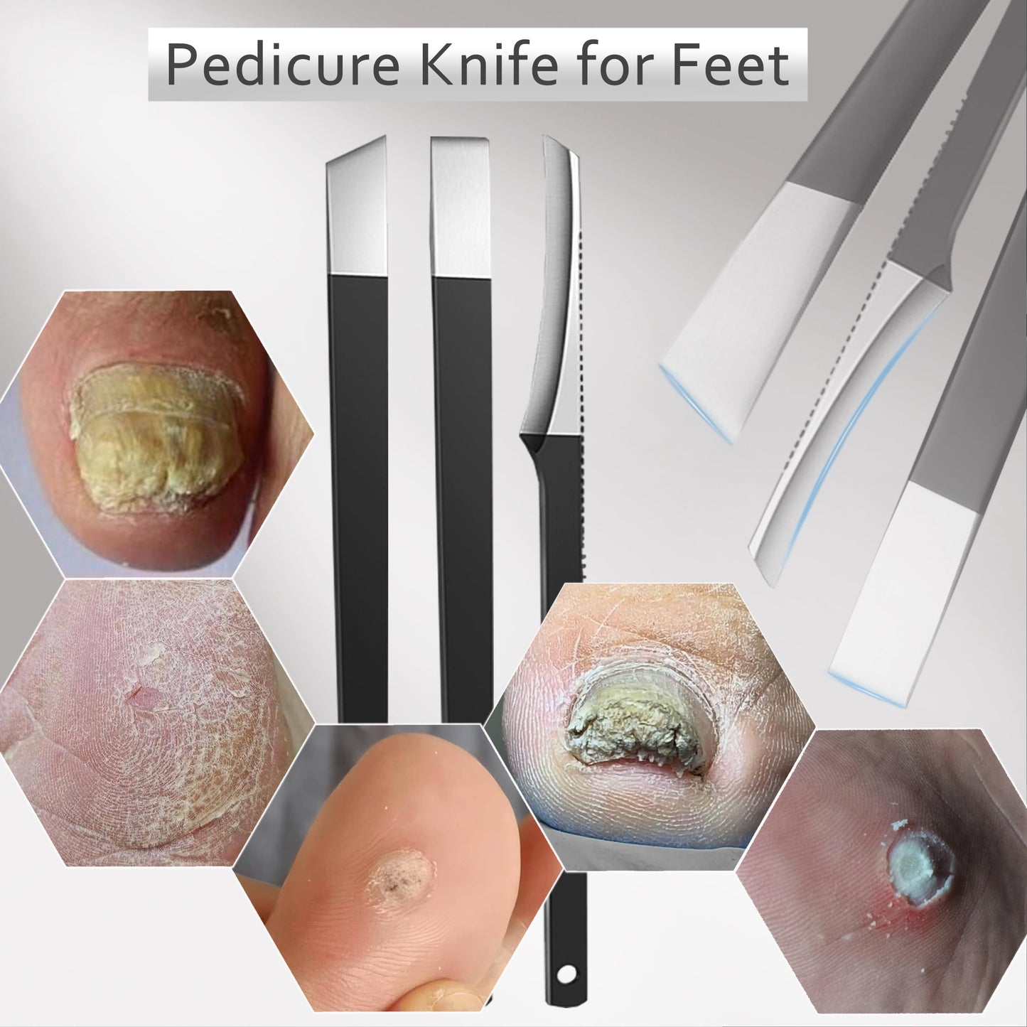 Toenail Clipper for Thick Nails Seniors Ingrown Toe Nail Pedicure Knife for Ingrown Nails Removal Kit Cutter Toenail