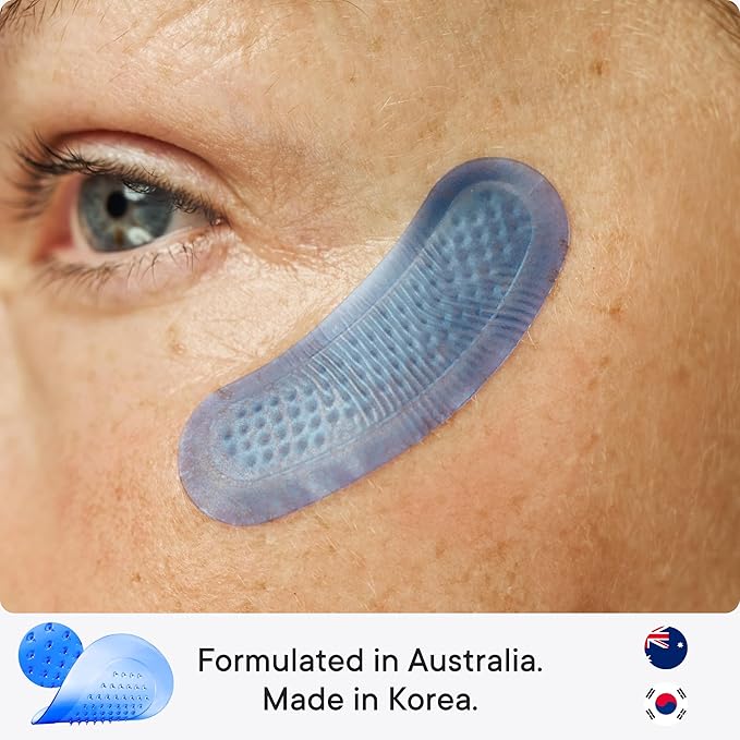 Qure Micro-Infusion Anti Wrinkle Patches for Smile Line, Frown lines, Under Eye Bags, Puffiness, Crow's Feet - Retinol, Caffeine, Peptides - Dissolvable for Overnight Use - 8 Pairs